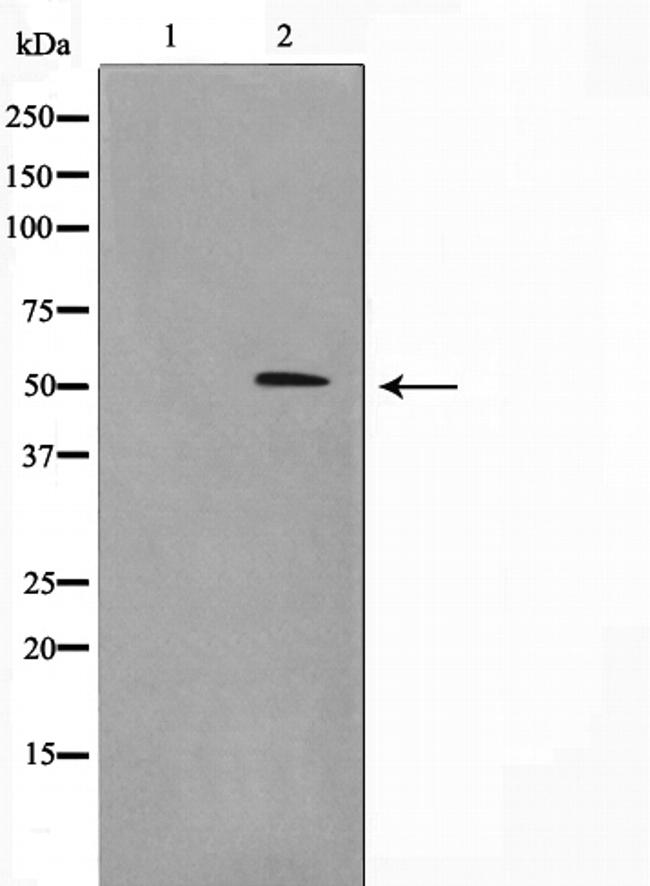 Menin Antibody in Western Blot (WB)