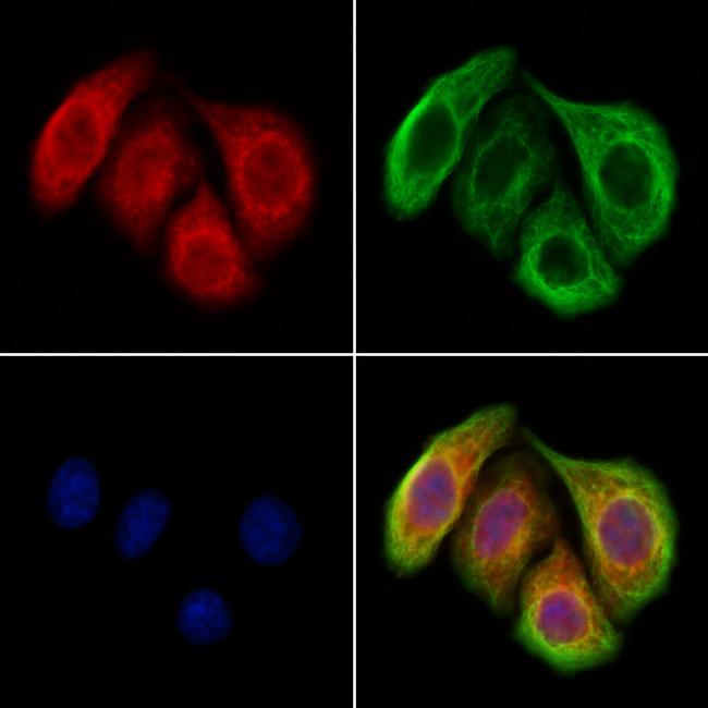 METL5 Antibody in Immunocytochemistry (ICC/IF)