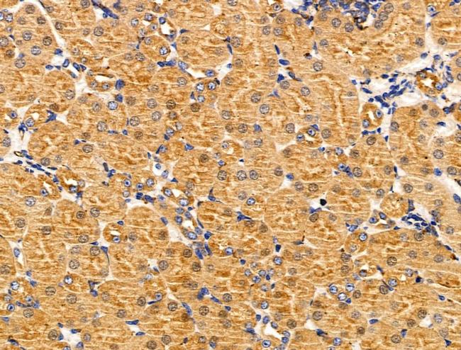 MTR Antibody in Immunohistochemistry (Paraffin) (IHC (P))