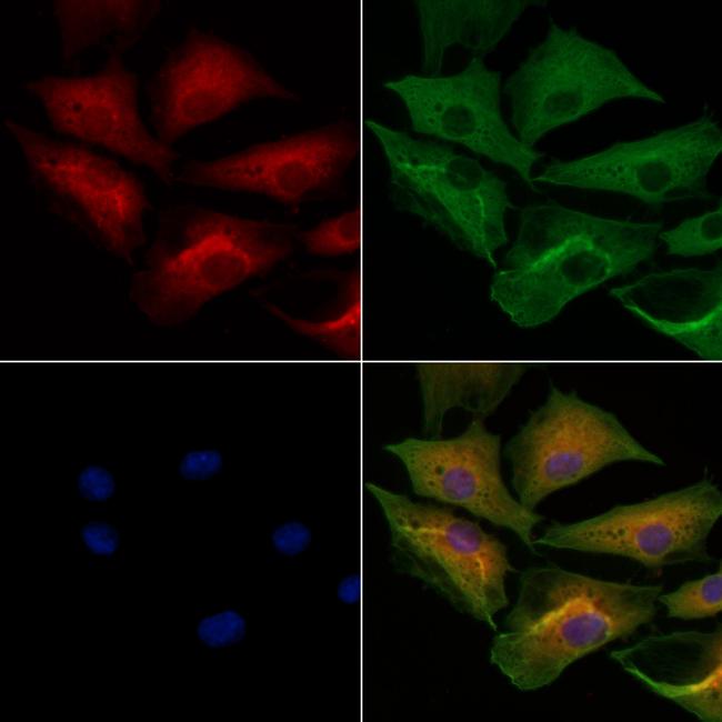 MYBPC3 Antibody in Immunocytochemistry (ICC/IF)