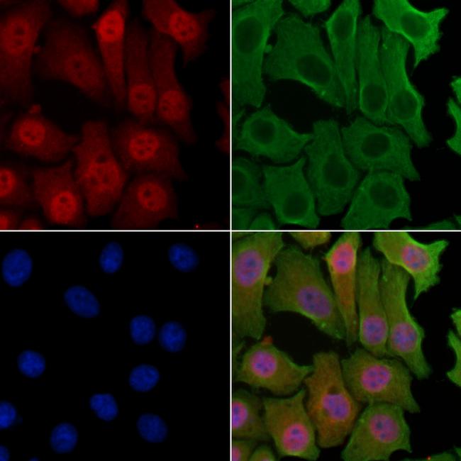 NCBP1 Antibody in Immunocytochemistry (ICC/IF)