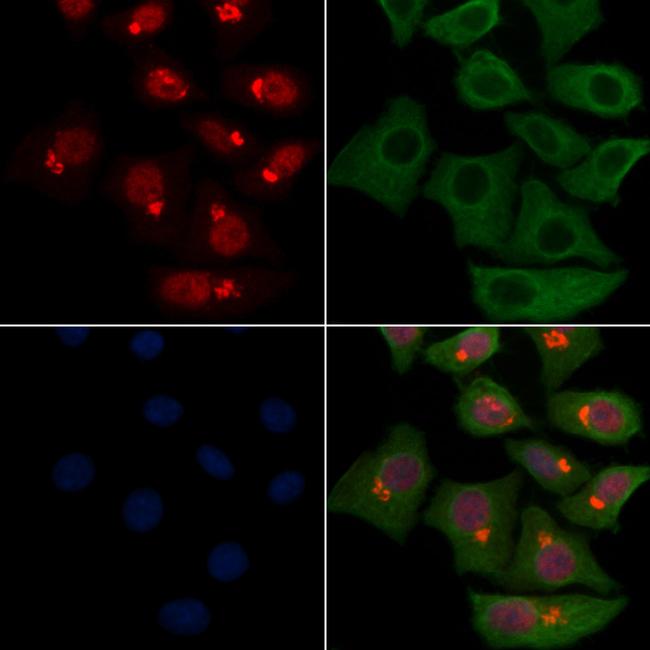 Neutrophil elastase Antibody in Immunocytochemistry (ICC/IF)