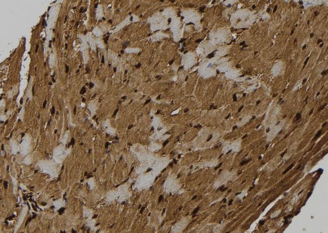 NLRP3 Antibody in Immunohistochemistry (Paraffin) (IHC (P))