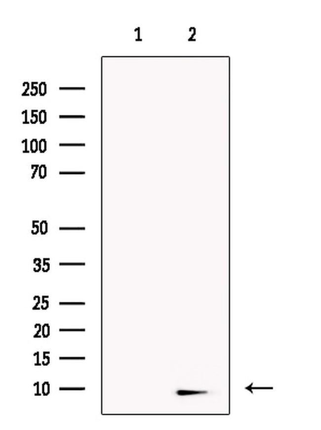 NOLA3 Antibody in Western Blot (WB)