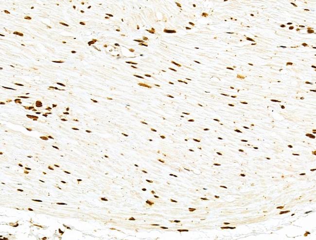 PXR Antibody in Immunohistochemistry (Paraffin) (IHC (P))