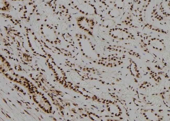 TR2 Antibody in Immunohistochemistry (Paraffin) (IHC (P))