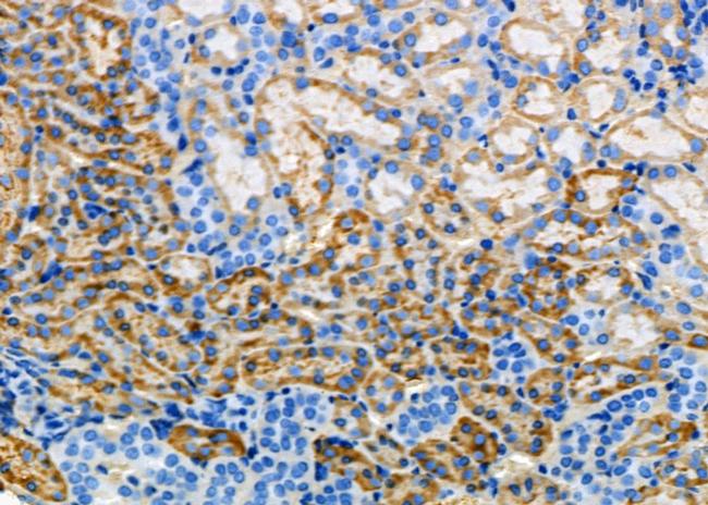 N-Ras Antibody in Immunohistochemistry (Paraffin) (IHC (P))