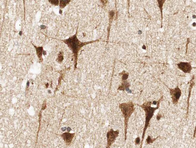 NFE2L2 Antibody in Immunohistochemistry (Paraffin) (IHC (P))