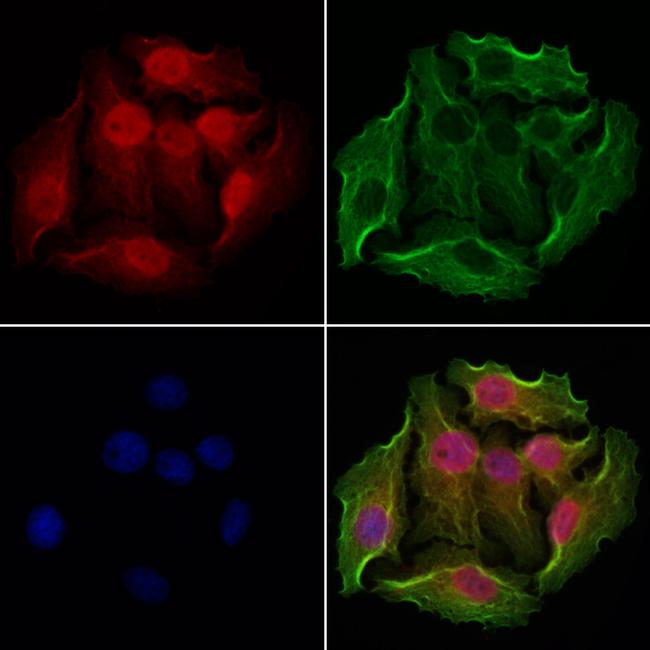 NSUN2 Antibody in Immunocytochemistry (ICC/IF)