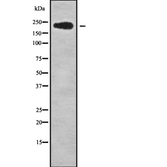 NUP214 Antibody in Western Blot (WB)