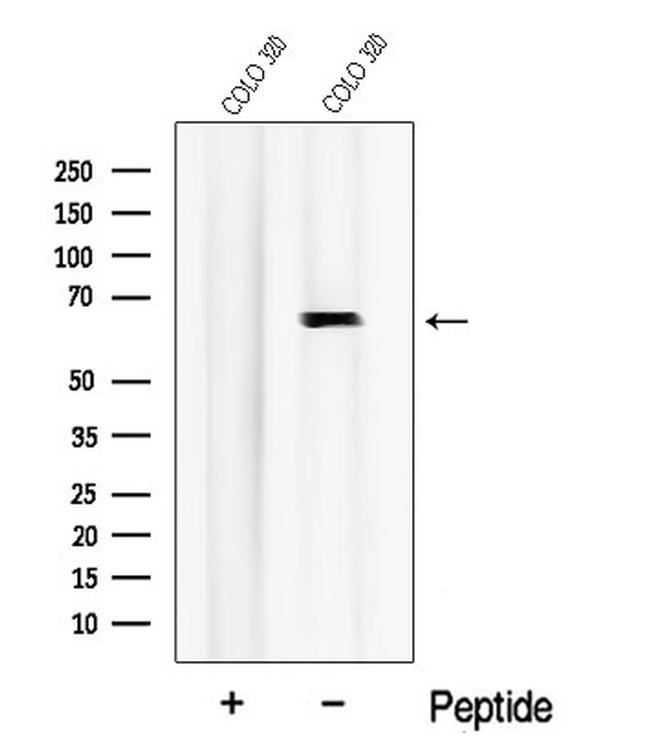 Nurr1 Antibody in Western Blot (WB)