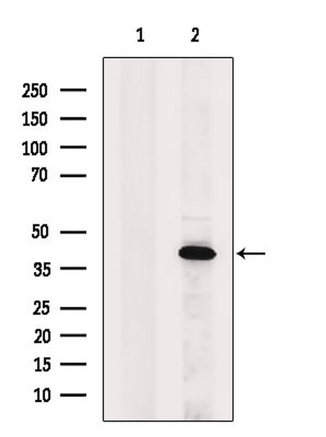 OGG1 Antibody in Western Blot (WB)