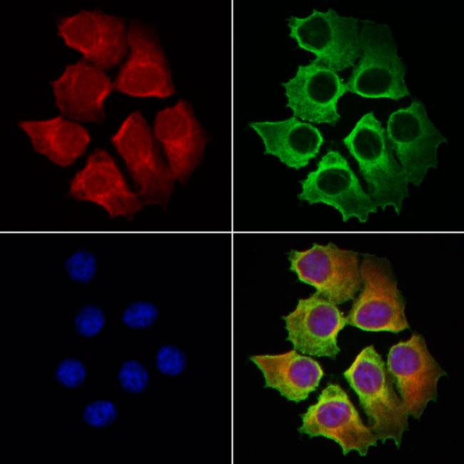 OSBP Antibody in Immunocytochemistry (ICC/IF)