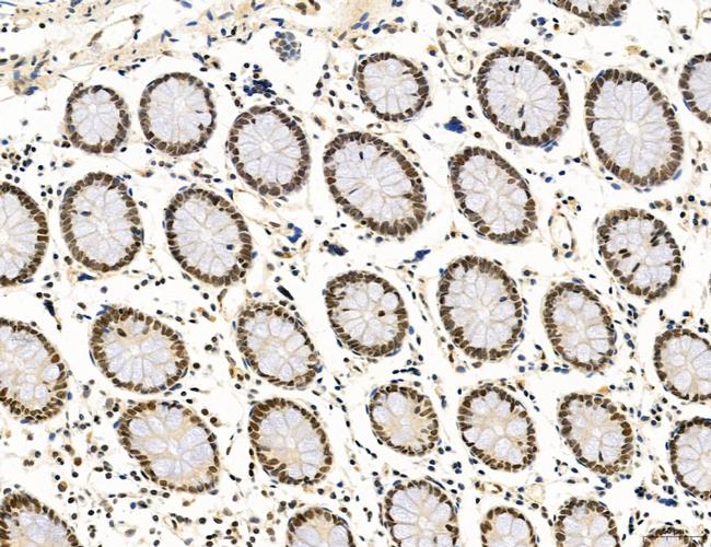 SP7 Antibody in Immunohistochemistry (Paraffin) (IHC (P))