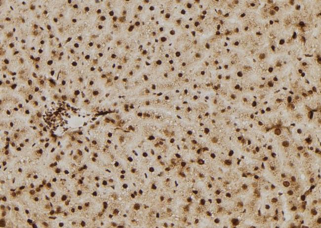 p14ARF Antibody in Immunohistochemistry (Paraffin) (IHC (P))