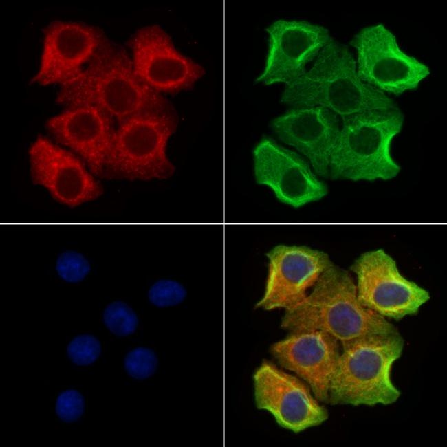 P2X3 Antibody in Immunocytochemistry (ICC/IF)