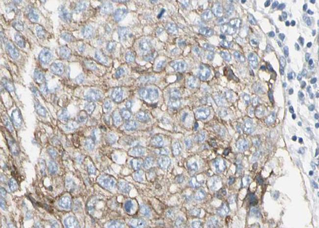 PAI1 Antibody in Immunohistochemistry (Paraffin) (IHC (P))