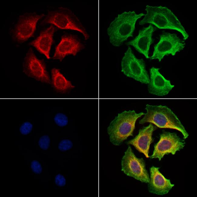 PDE1C Antibody in Immunocytochemistry (ICC/IF)