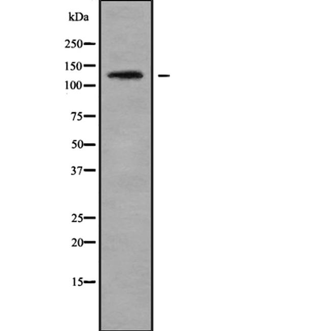 PDE3A Antibody in Western Blot (WB)