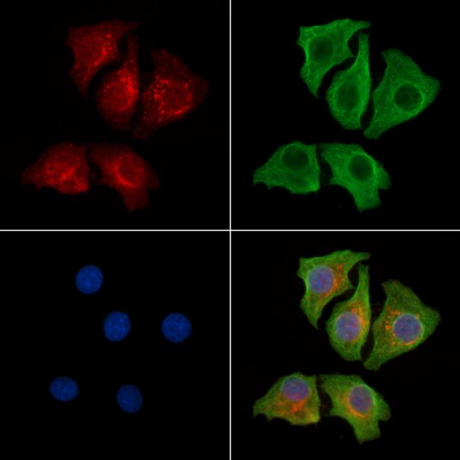 PDK1 Antibody in Immunocytochemistry (ICC/IF)