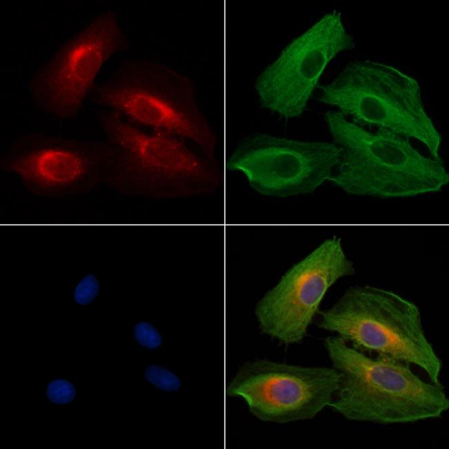 PERK Antibody in Immunocytochemistry (ICC/IF)