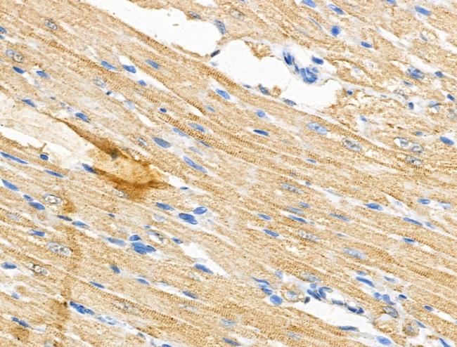 PGAM5 Antibody in Immunohistochemistry (Paraffin) (IHC (P))