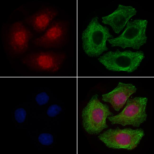 PKA alpha Antibody in Immunocytochemistry (ICC/IF)