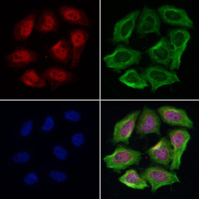 PLCB1 Antibody in Immunocytochemistry (ICC/IF)