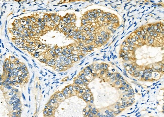 PLCD1 Antibody in Immunohistochemistry (Paraffin) (IHC (P))