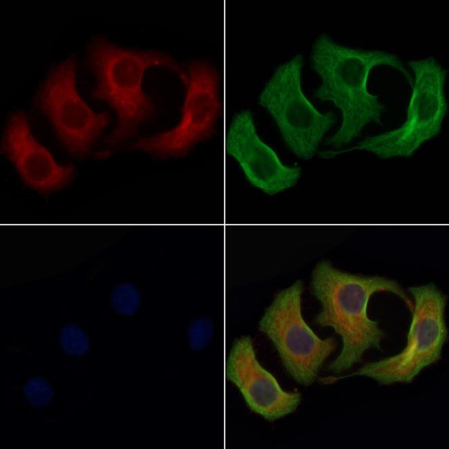 PNP Antibody in Immunocytochemistry (ICC/IF)