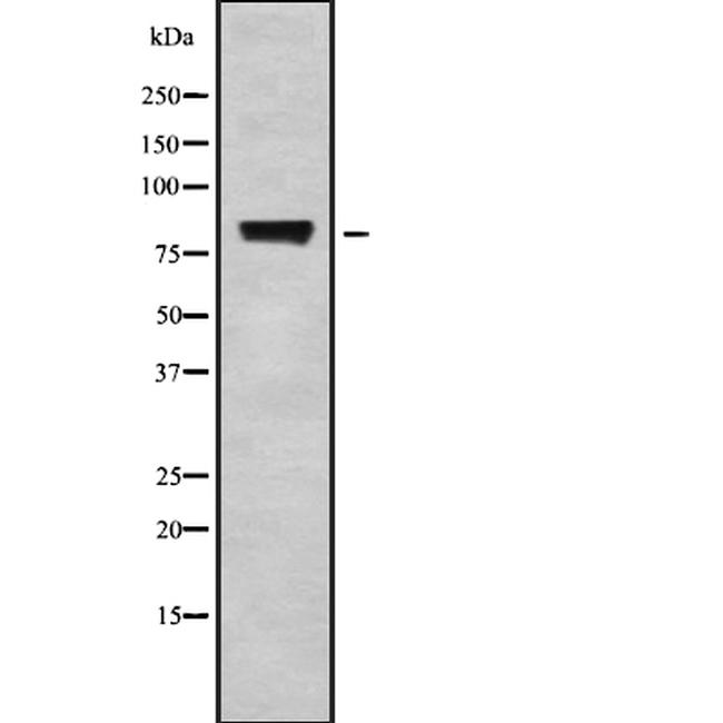 POLR3E Antibody in Western Blot (WB)