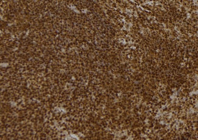 PON2 Antibody in Immunohistochemistry (Paraffin) (IHC (P))