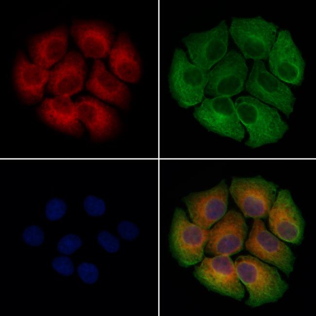 PF4 Antibody in Immunocytochemistry (ICC/IF)