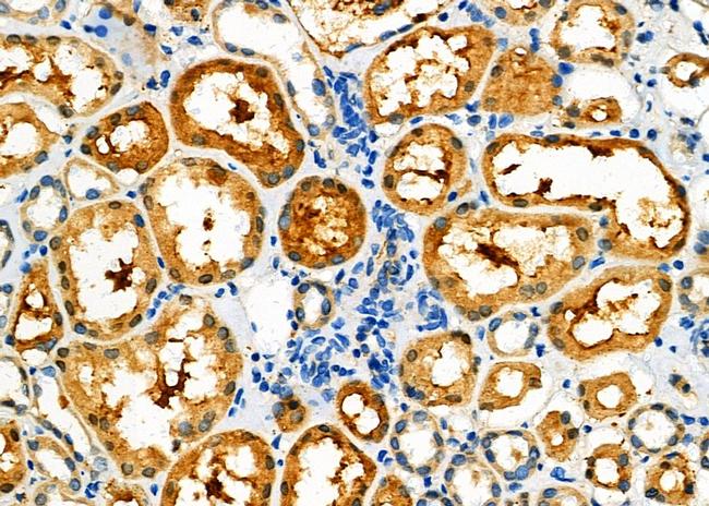 PPP2R2A Antibody in Immunohistochemistry (Paraffin) (IHC (P))