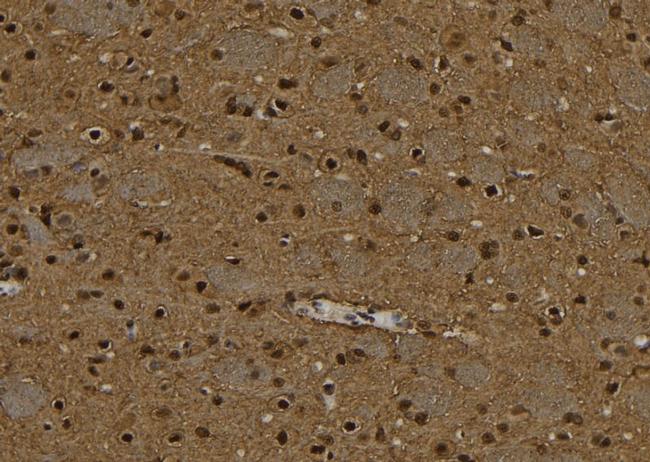 PPP4C Antibody in Immunohistochemistry (Paraffin) (IHC (P))