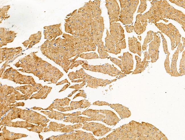 PR3 Antibody in Immunohistochemistry (Paraffin) (IHC (P))