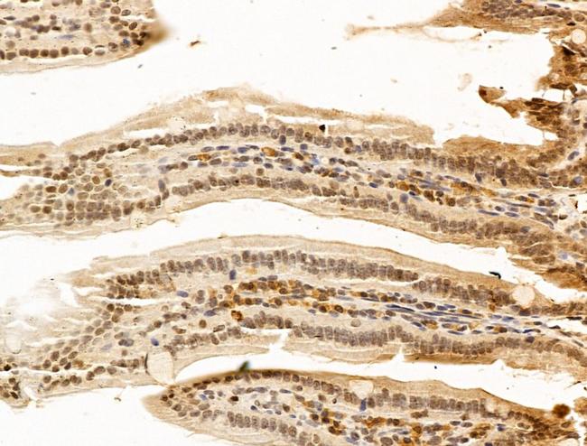 PRDM2 Antibody in Immunohistochemistry (Paraffin) (IHC (P))