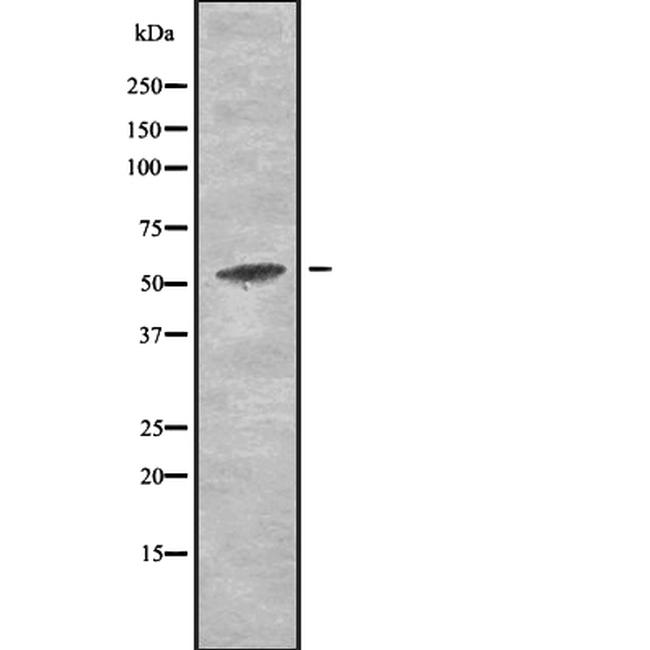 AMPK alpha-2 Antibody in Western Blot (WB)