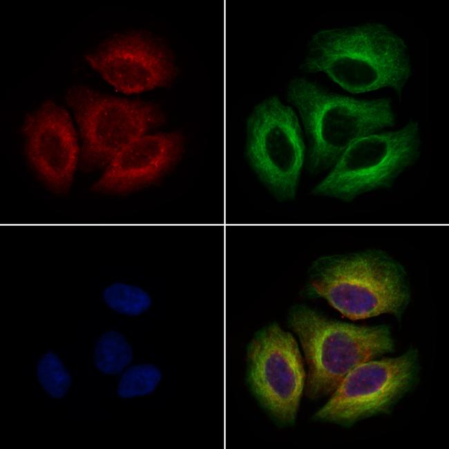 PTCH2 Antibody in Immunocytochemistry (ICC/IF)