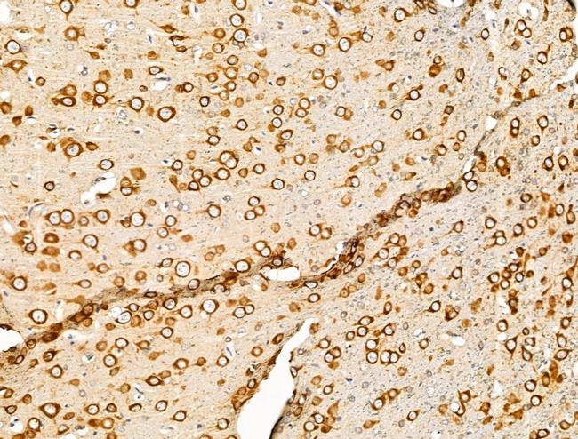 PURA Antibody in Immunohistochemistry (Paraffin) (IHC (P))