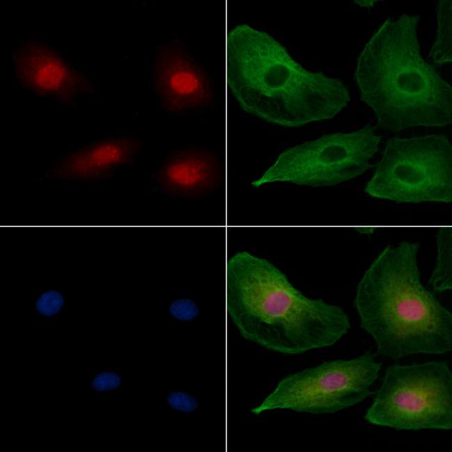 PYGO2 Antibody in Immunocytochemistry (ICC/IF)