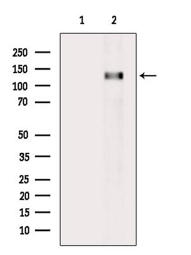 PYK2 Antibody in Western Blot (WB)