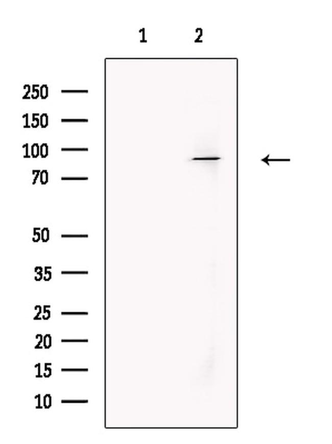 MEFV Antibody in Western Blot (WB)