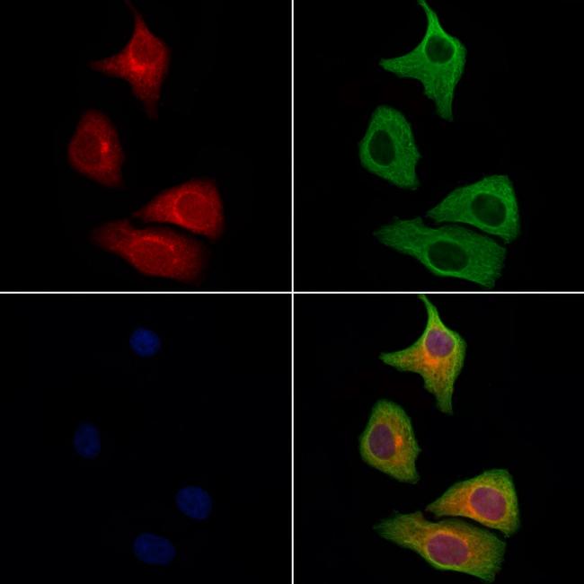 RAB11FIP1 Antibody in Immunocytochemistry (ICC/IF)