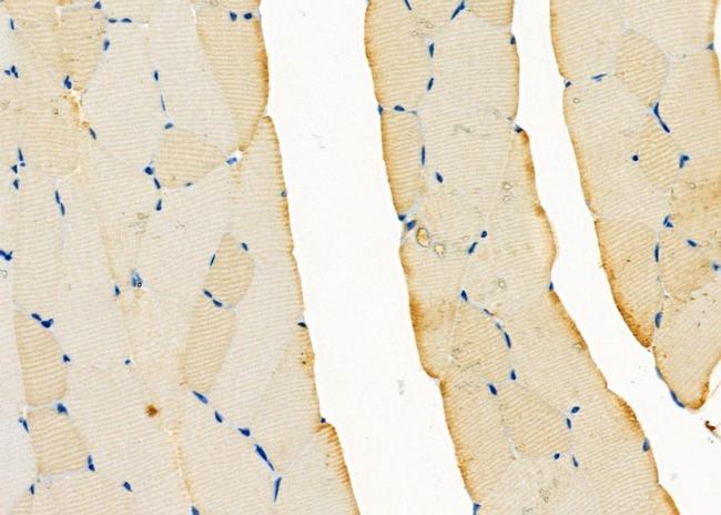 RAB11FIP5 Antibody in Immunohistochemistry (Paraffin) (IHC (P))