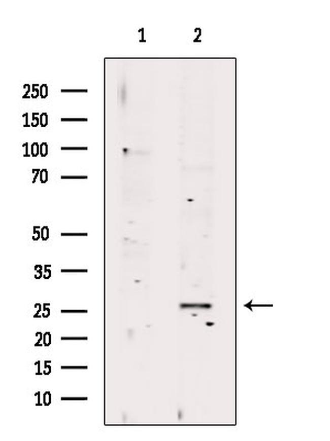 RAB23 Antibody in Western Blot (WB)