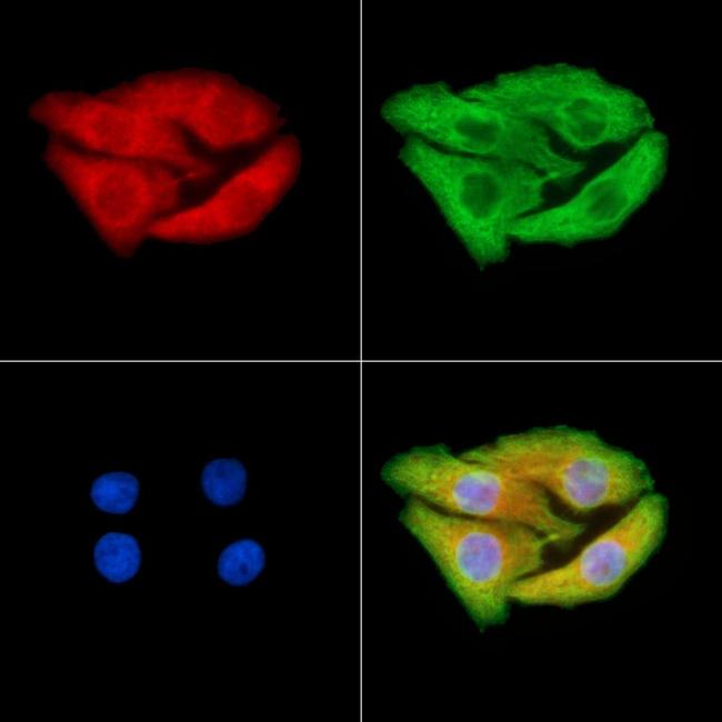 RALB Antibody in Immunocytochemistry (ICC/IF)