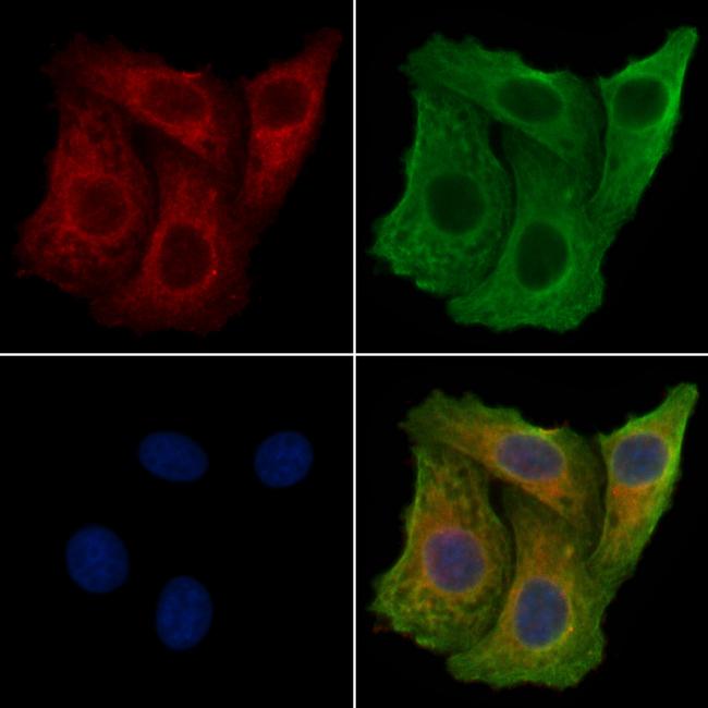 RBCK1 Antibody in Immunocytochemistry (ICC/IF)