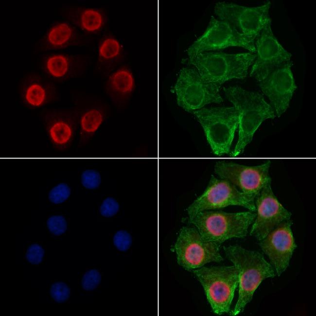 RBM3 Antibody in Immunocytochemistry (ICC/IF)