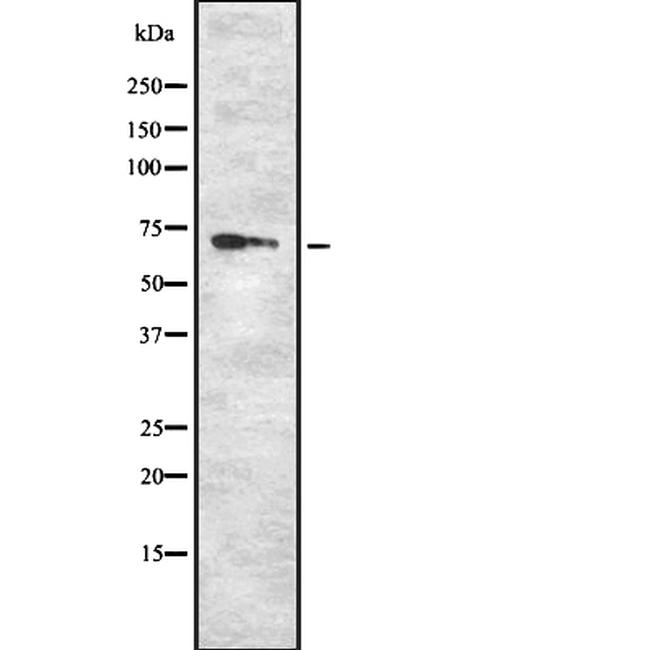 RYK Antibody in Western Blot (WB)